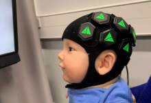 کلاهی برای بررسی مغز نوزادان